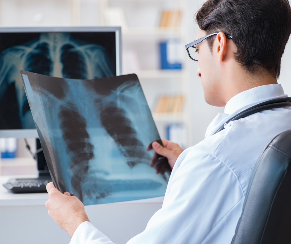 Over-the-shoulder view of young male doctor looking at chest xray