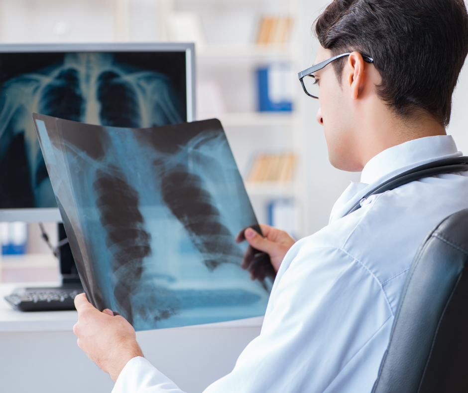 Doc-lung-cancer
